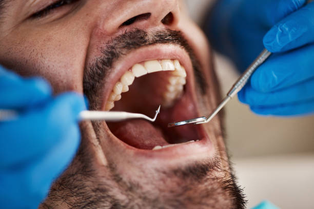 Best Urgent Care for Lost Fillings or Crowns in Valmeyer, IL