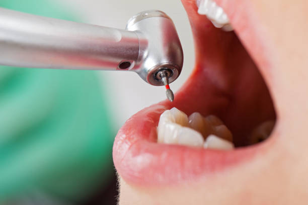 Best Same-Day Emergency Dental Services in Valmeyer, IL